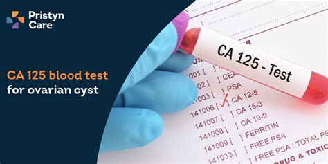 c125 blood test for ovarian cancer.